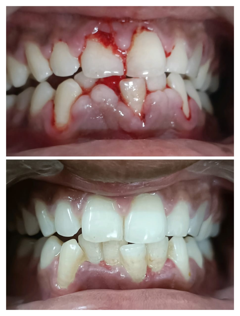 After Treatment